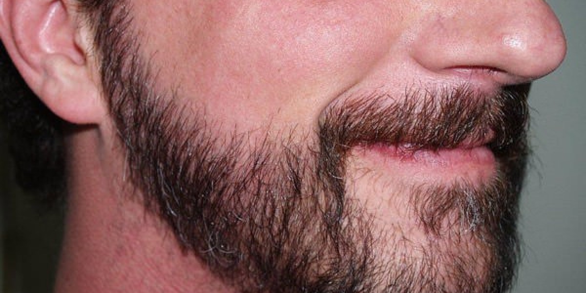 Who is the Ideal Candidate for a Beard Hair Transplant?