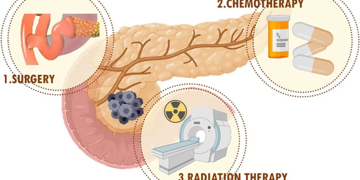 Pancreatic Cancer Treatment Market Analysis of Current and Future Industry Trends and Growth till 2034