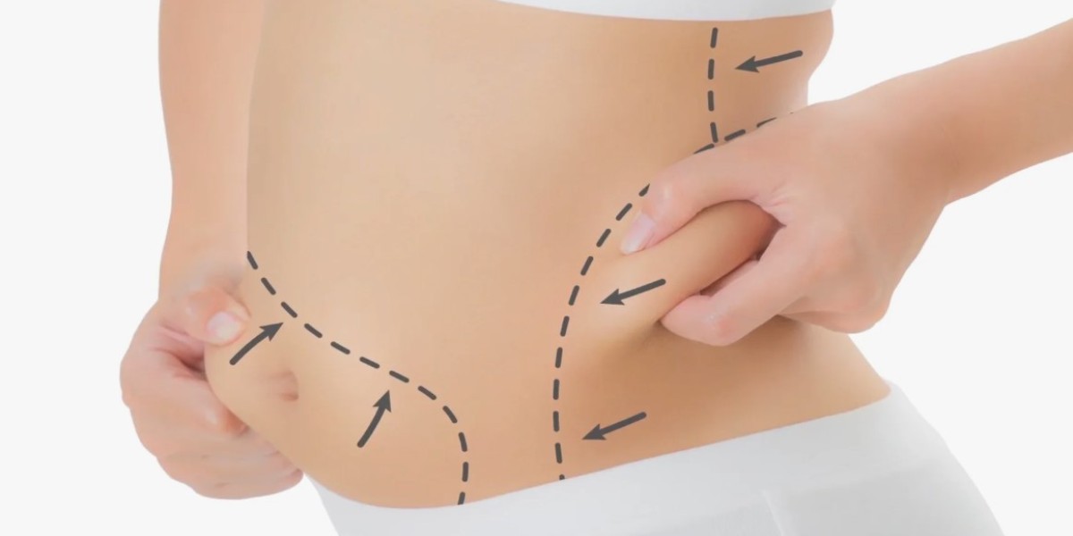 Choosing the Right Surgeon for VASER Liposuction in Riyadh