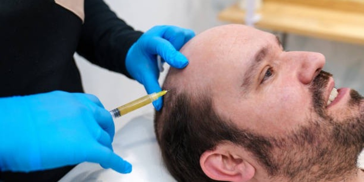 قبل وبعد زراعة الشعر في الرياض – نتائج مذهلة