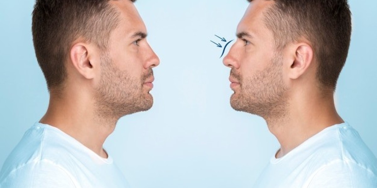 Will My Nose Keep Changing After Rhinoplasty?