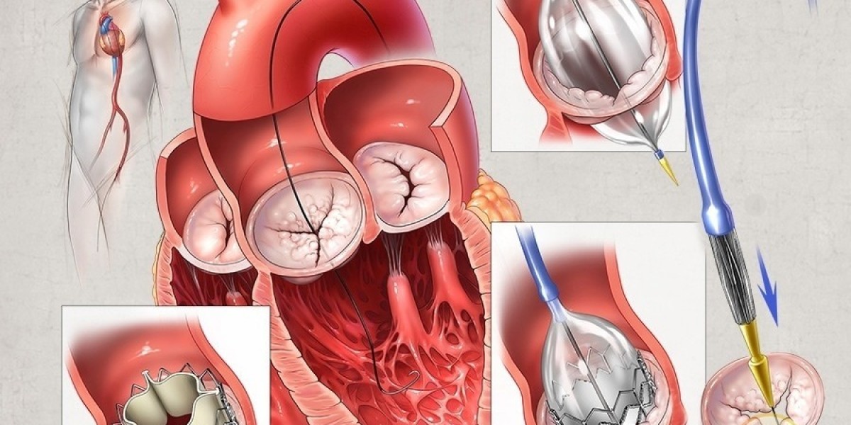 Prosthetic Heart Valves Market Report: Technological Advancements in Imaging Techniques Improving Valve Placement Accura