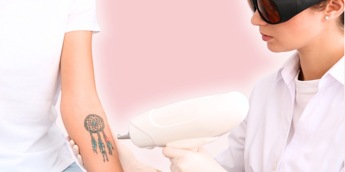 Next-Gen Laser Tattoo Removal – Because Science Works!
