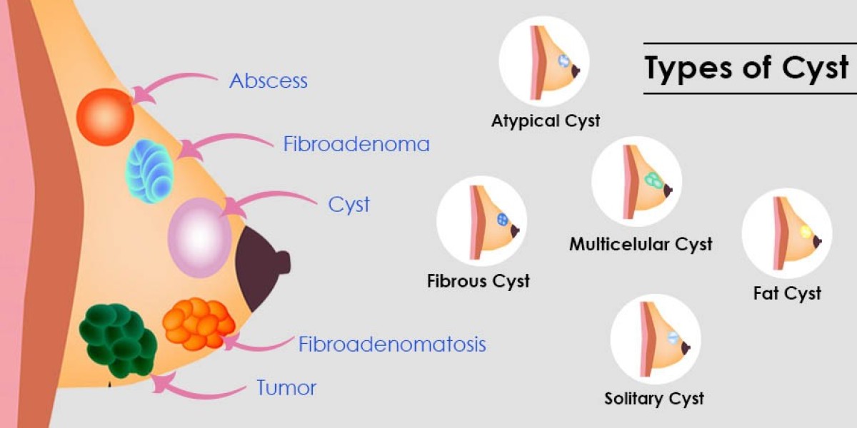 Minimally Invasive Biopsy Options for Diagnosis