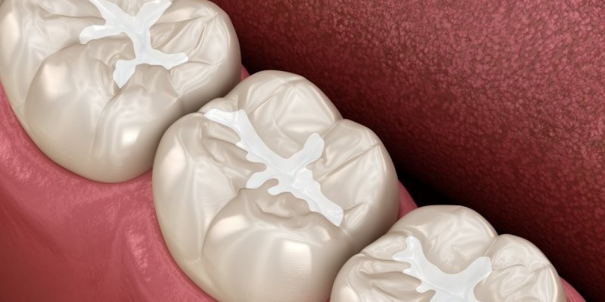 Tooth Filling Cost Guide: What to Expect