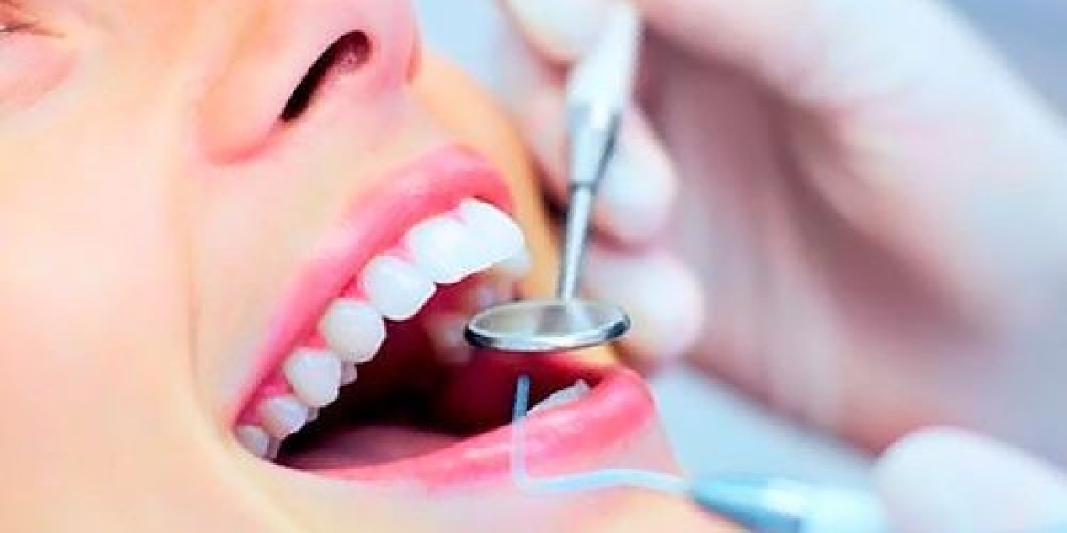 Ultimate Guide to Teeth Cleaning and Polishing in Riyadh