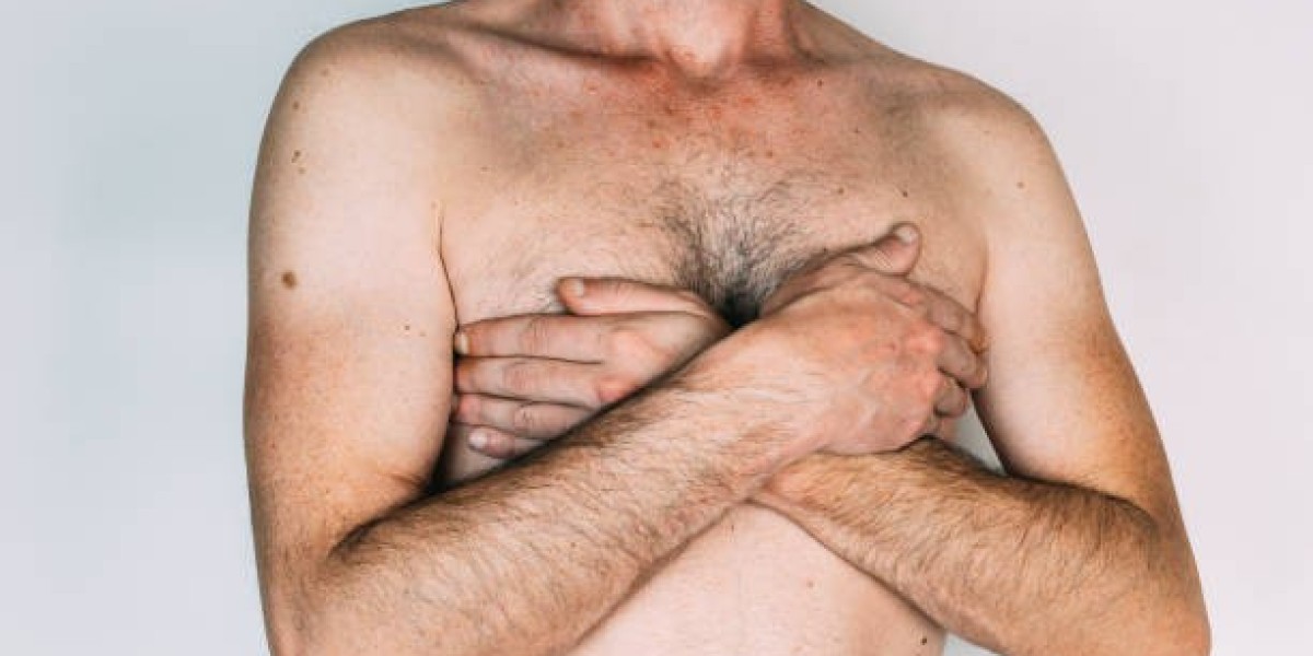Transform Your Look with Gynecomastia Surgery in Riyadh – Contact Now