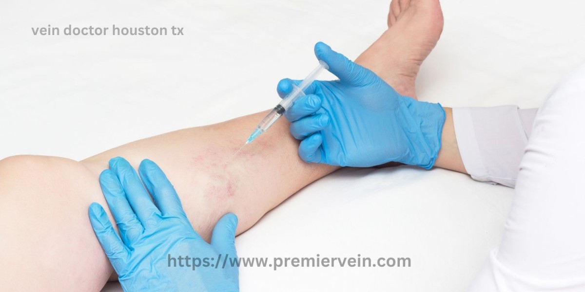 What Are the Risks of Untreated Varicose Veins?