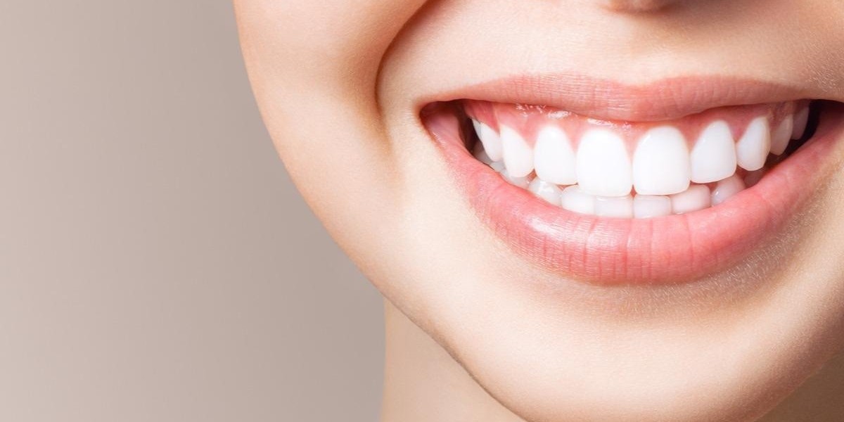 Discover Dubai’s Teeth Whitening Success Stories