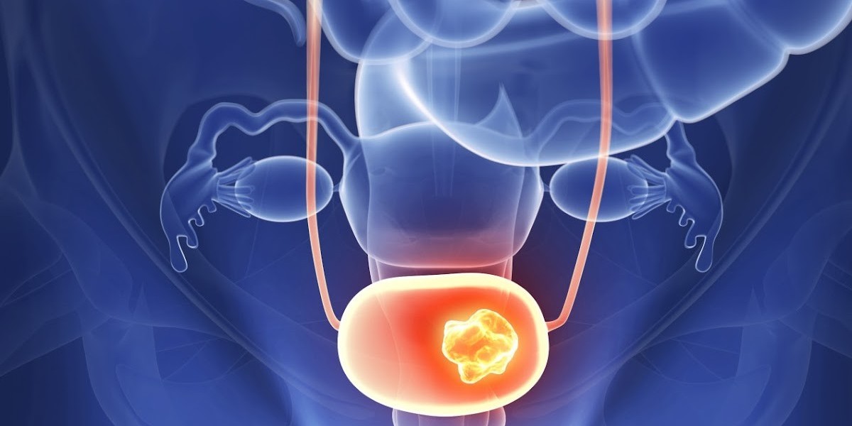 Bladder Cancer Therapeutics Market Report: By Types, By applications, By Manufacturers, Forecast 2034