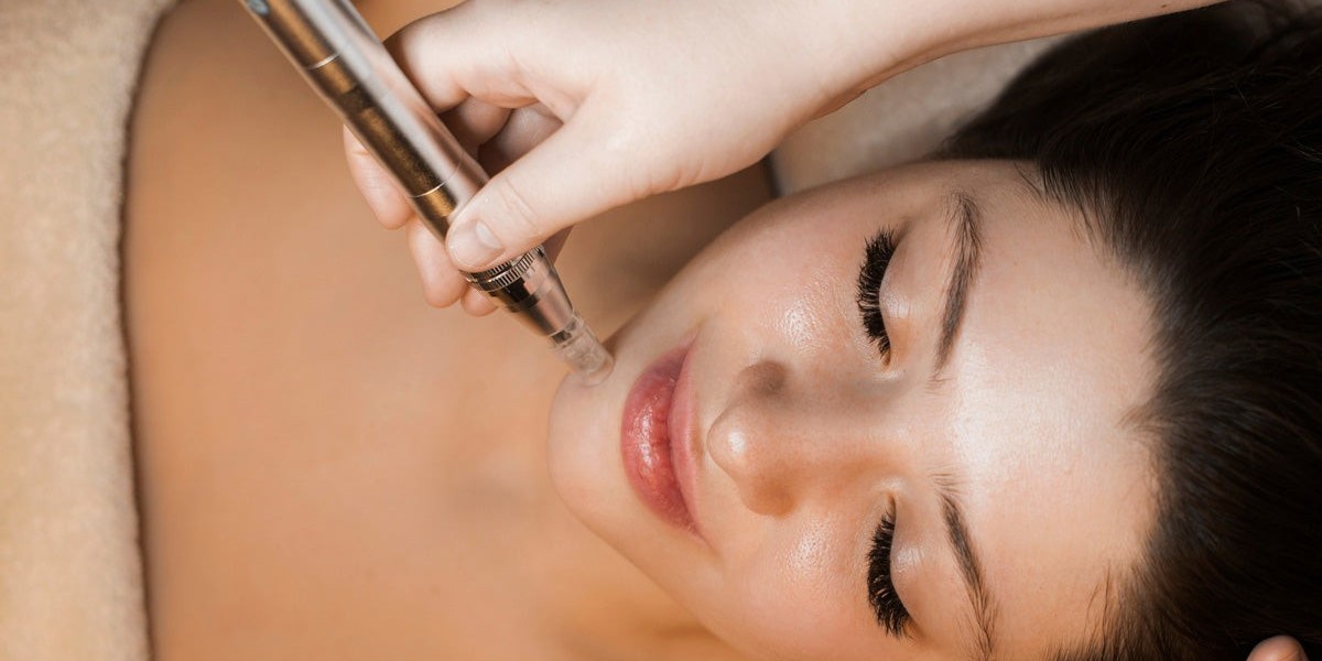 How Morpheus8 Combines Microneedling and Radiofrequency for Flawless Skin
