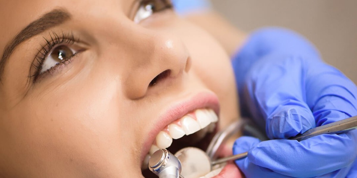 Simple vs. Surgical Tooth Extraction in Dubai: A Guide to a Healthy Smile