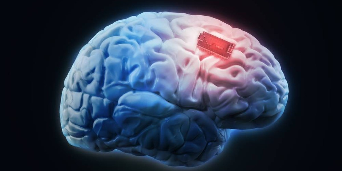 Navigating the Brain Implants Industry: Market Size and Emerging Opportunities