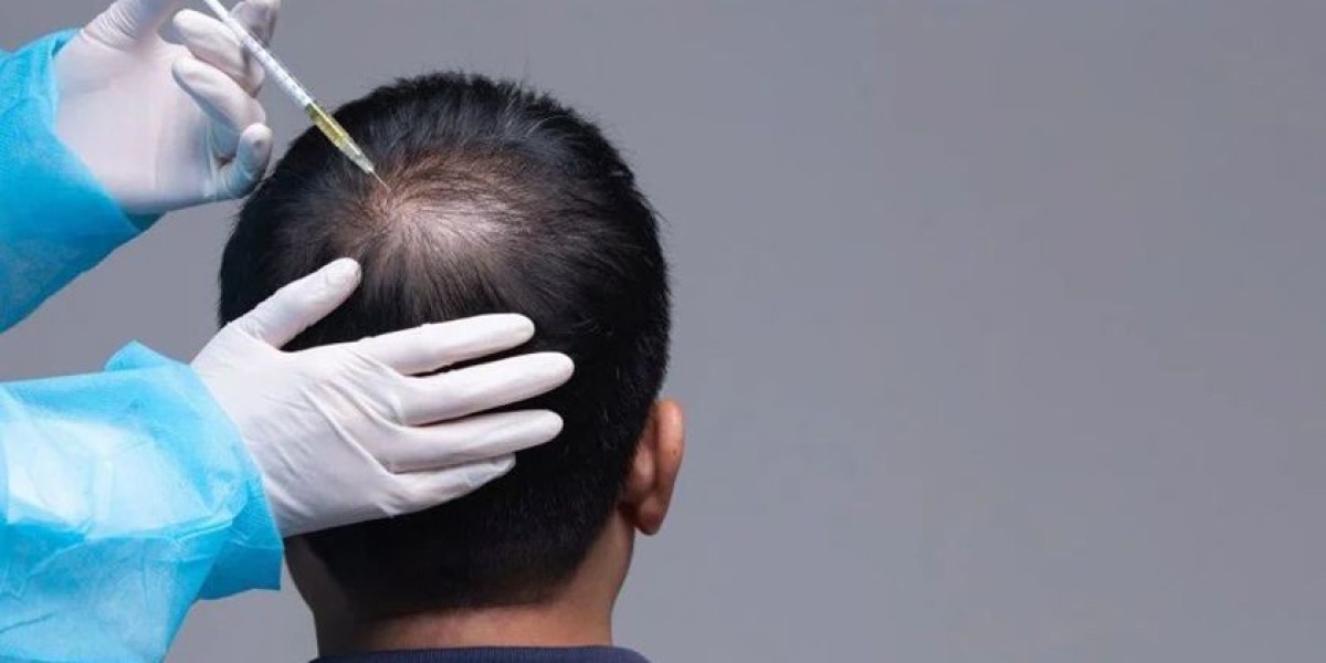GFC Hair Transplant for Men and Women in Riyadh