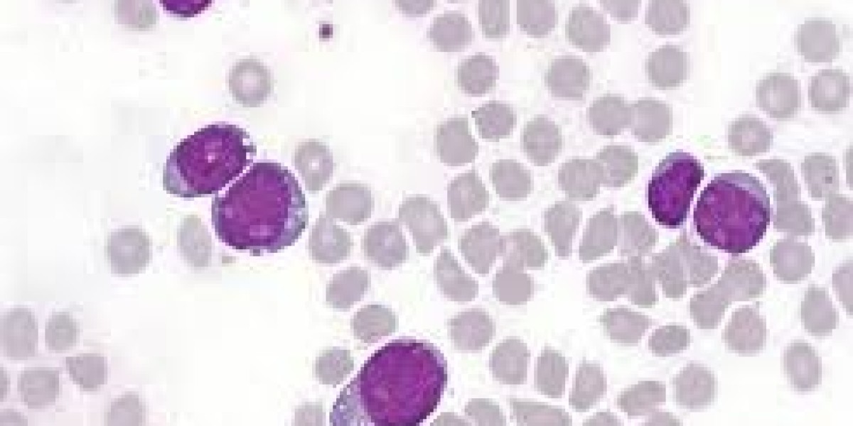 T-cell Acute Lymphoblastic Leukemia Market Latest Trends with Future Insights by 2031