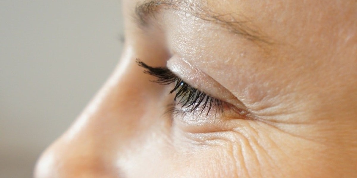 Say Goodbye to Crow’s Feet: Riyadh’s Best Treatments