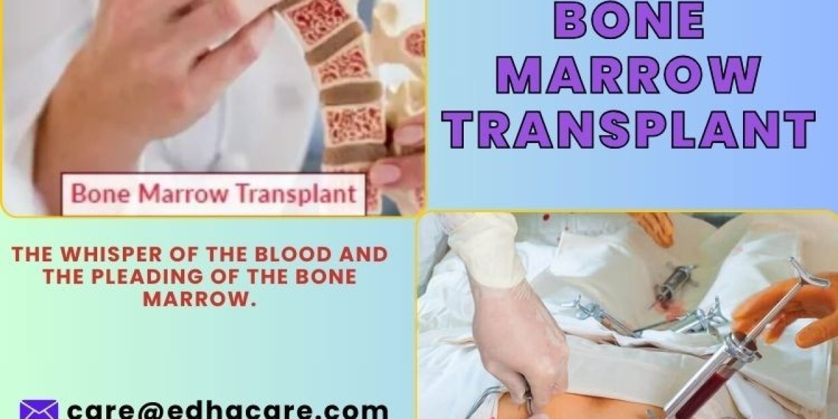 Leukemia Bone Marrow Transplant Life Expectancy: What Need To Know