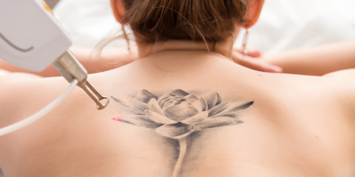 Dubai’s World-Class Tattoo Removal Clinics: Pioneering Innovation and Results