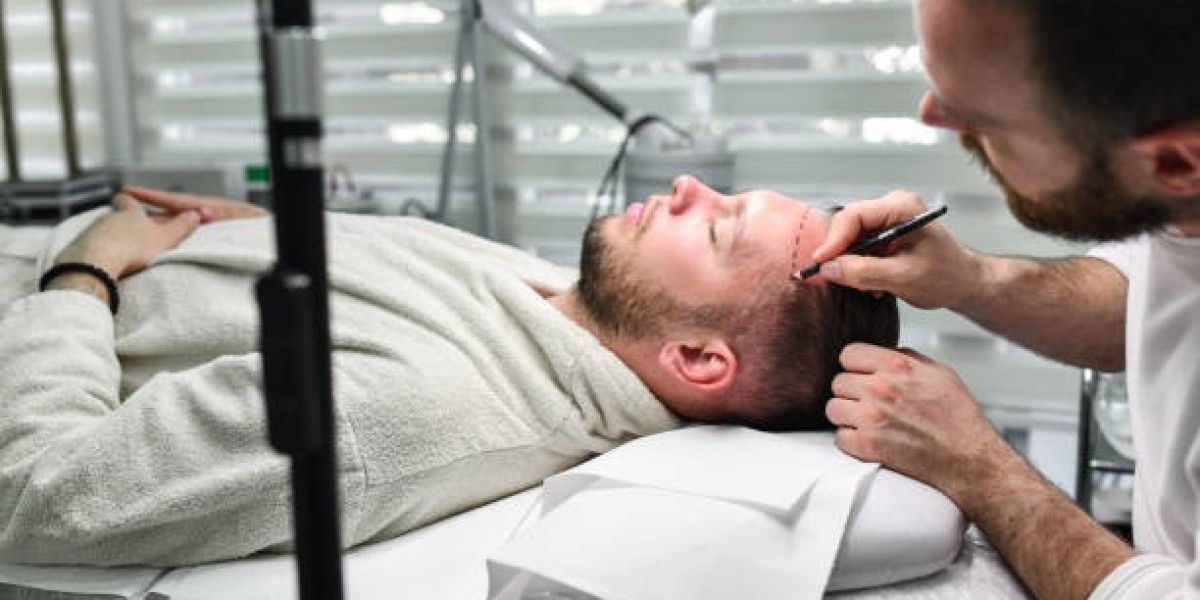 Hair Transplant in Riyadh – Beginner’s Guide