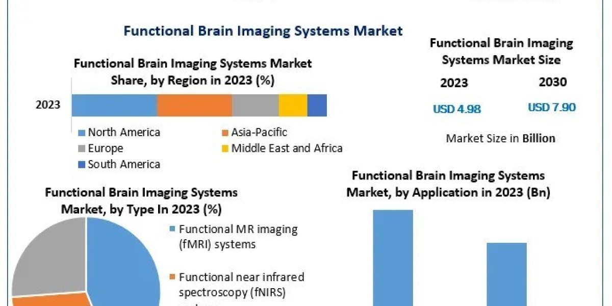 Functional Brain Imaging Systems Market Growth Top Vendors, Recent And Future Trends, Factors, Size, Segmentation, and F