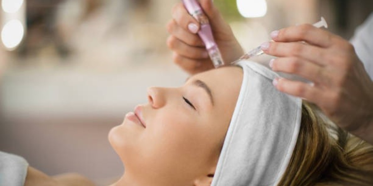 Chemical Peels in Riyadh: Expert Tips