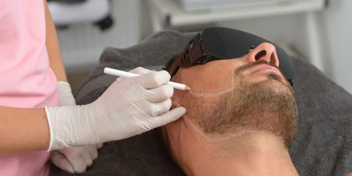 Laser Hair Removal: Redefining Standards in Male Grooming