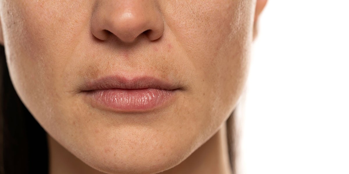 Pico Laser: The Laser that Works Wonders