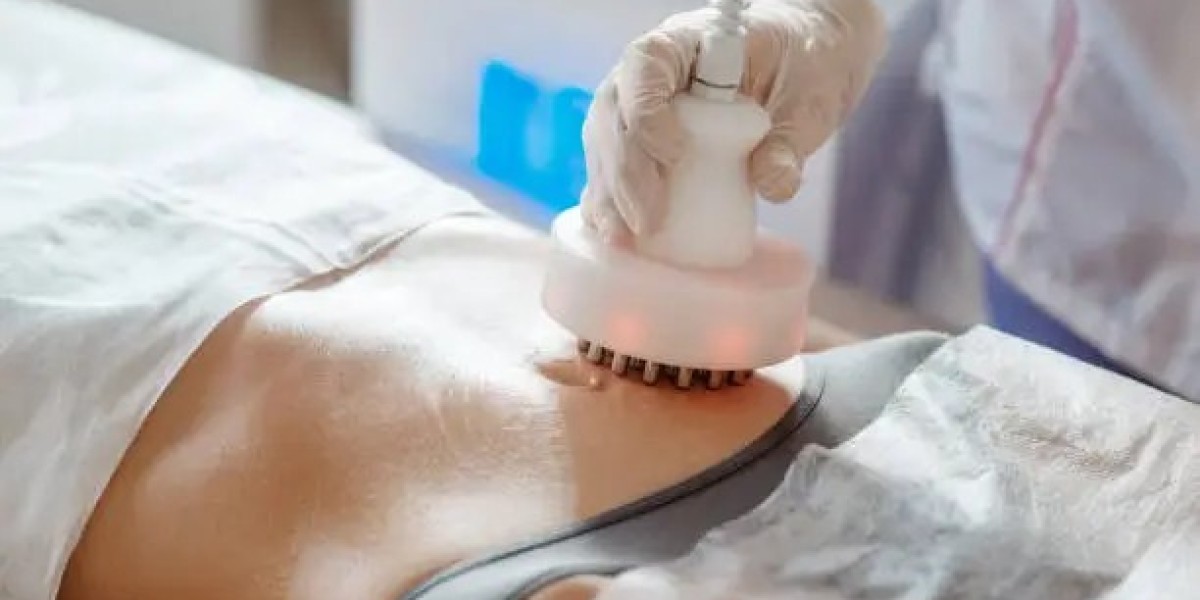 Fat Freezing in Dubai for Arms, Thighs, and Love Handles