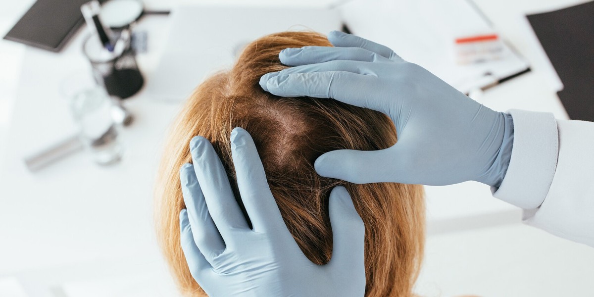 Bring Your Hair Back to Life with Our Hair Loss Treatment!