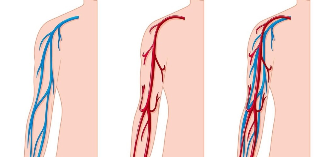 Exploring the Global Vascular Patches Market: Innovations & Insights