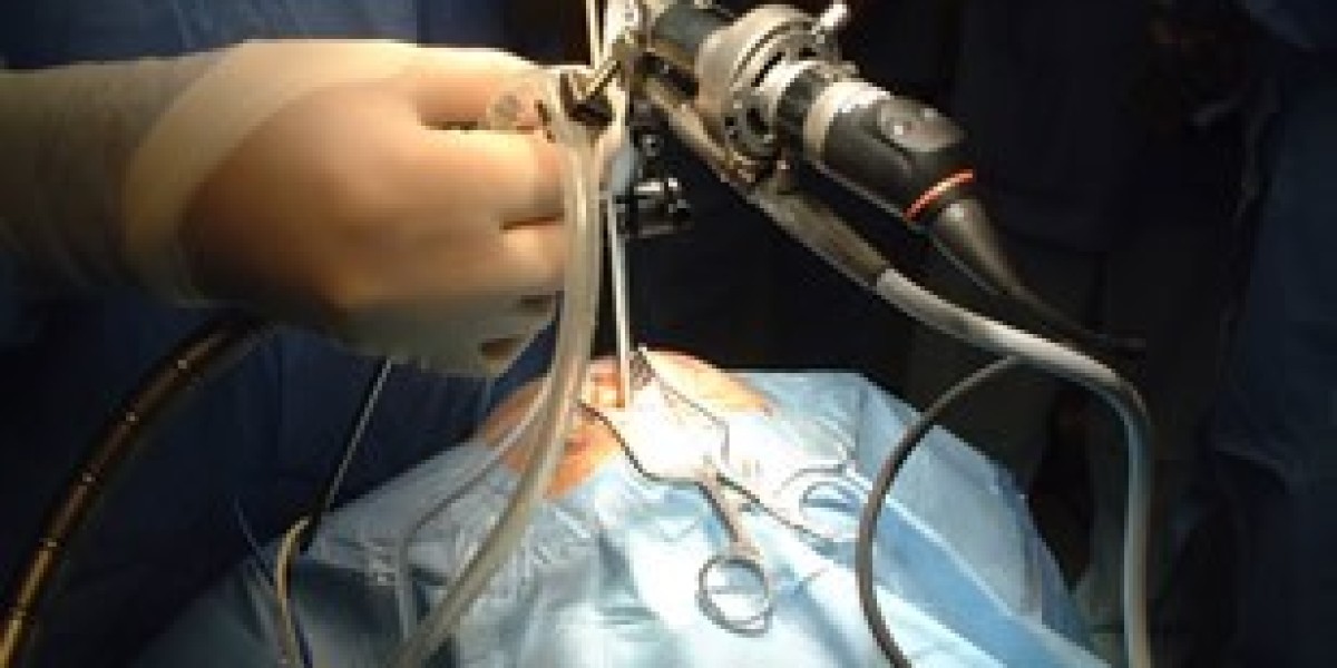 Neuroendoscopy Market: Advancements, Trends, and Future Growth Prospects