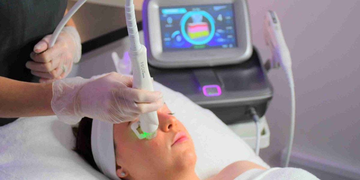 Fractional RF Microneedling: The Glow Boost You Need