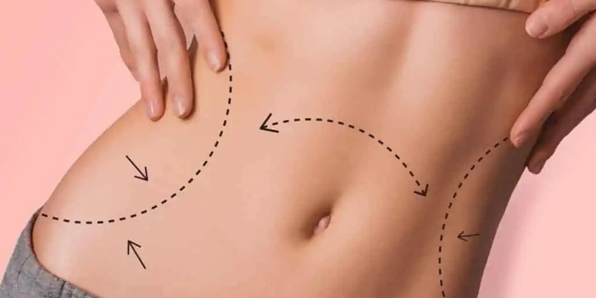 Get the Sleek, Sculpted Body You Deserve with Liposuction