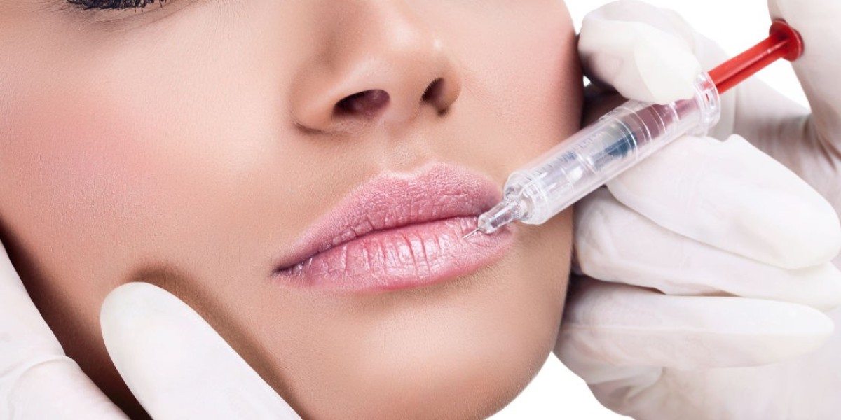 Enhance Your Natural Beauty with Dermal Fillers Southampton: What You Need to Know