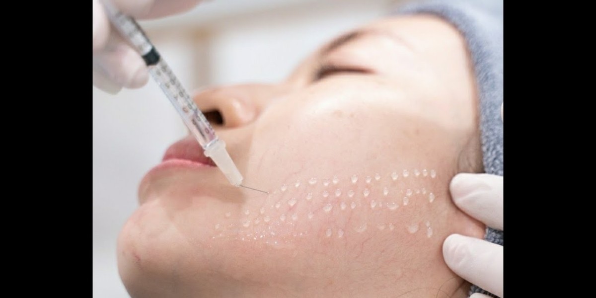 Mesotherapy for Double Chin Reduction – Riyadh Experts Speak