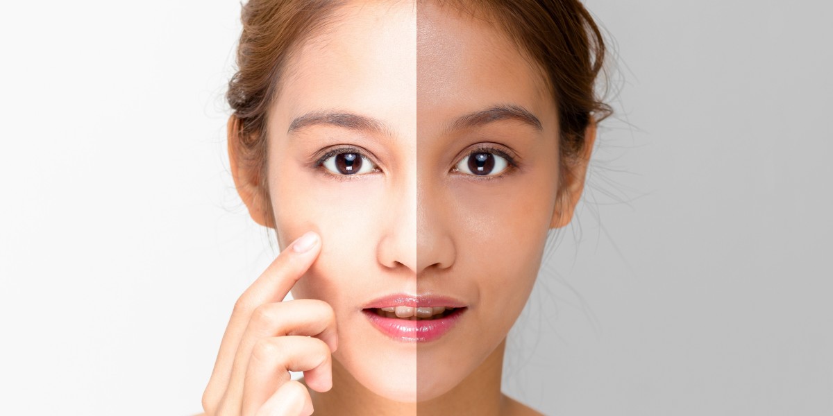 Skin Lightening Cream Market Analysis, Size, Share, Growth, Trends, and Forecasts by 2031