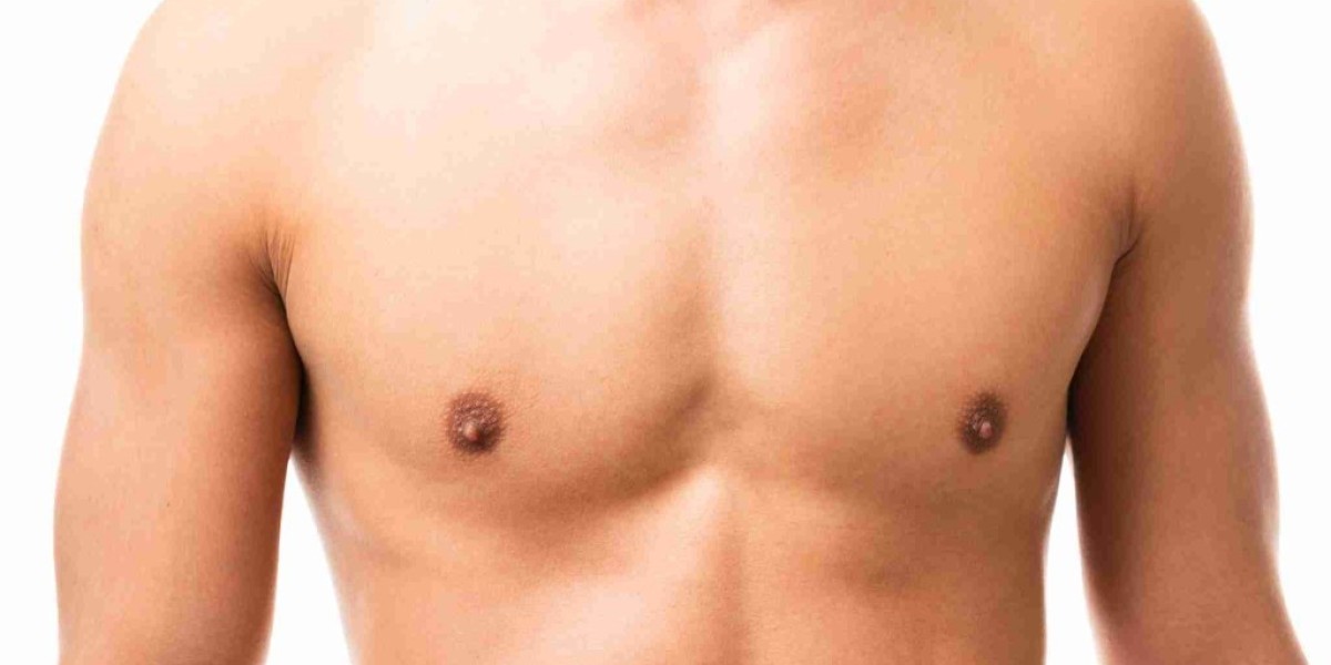 Say Goodbye to Gynecomastia: The Best Treatments Explained