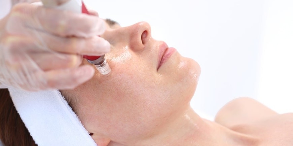 The Magic Behind PRP Vampire Facial: A Complete Guide
