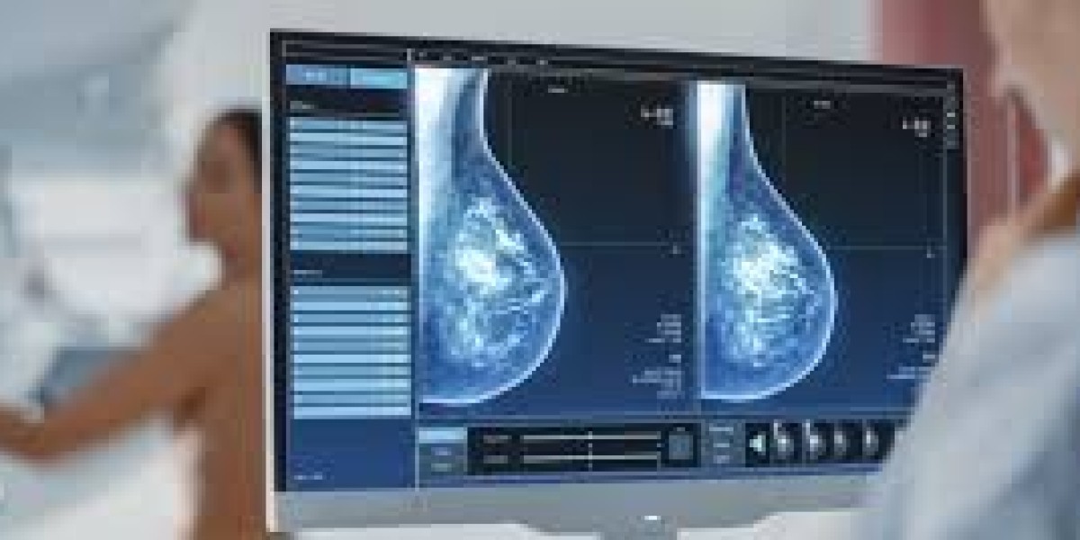 The Growing Breast Imaging Market: Innovations and Future Trends