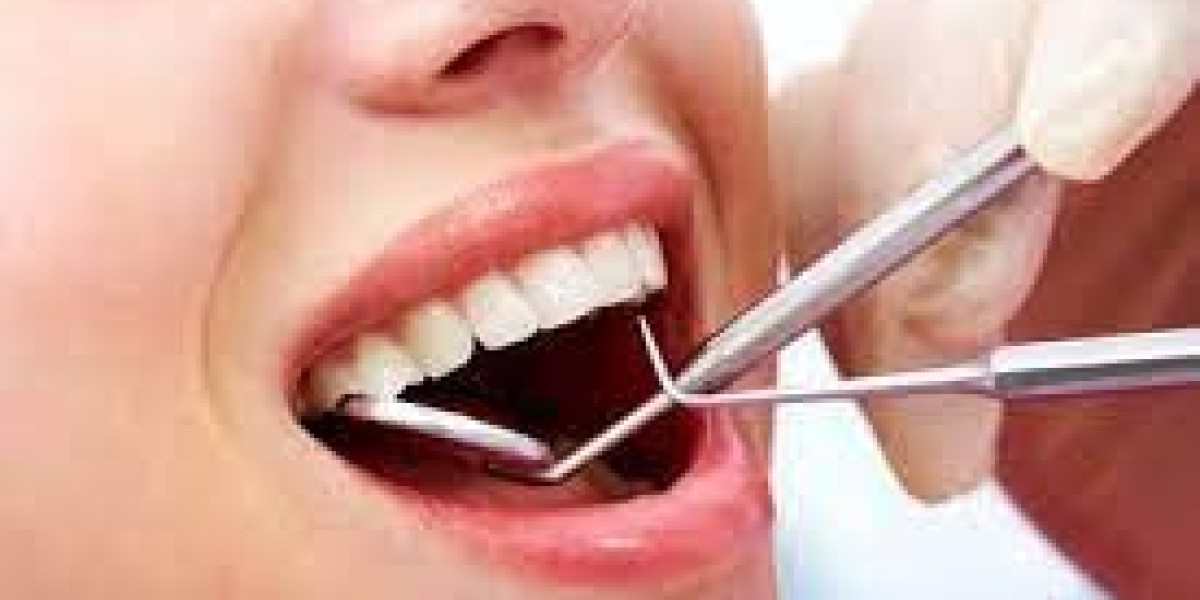 Revamp Your Smile with Composite Veneers in Dubai