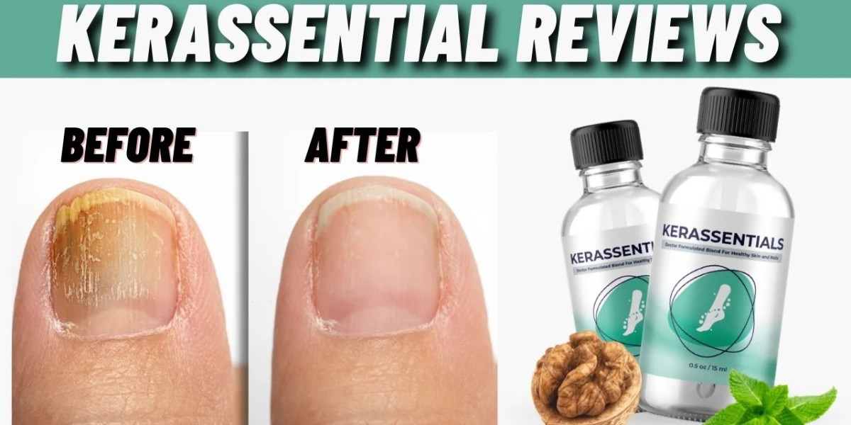 Kerassentials :-[IS FAKE or REAL?] Read About 100% Natural Product?