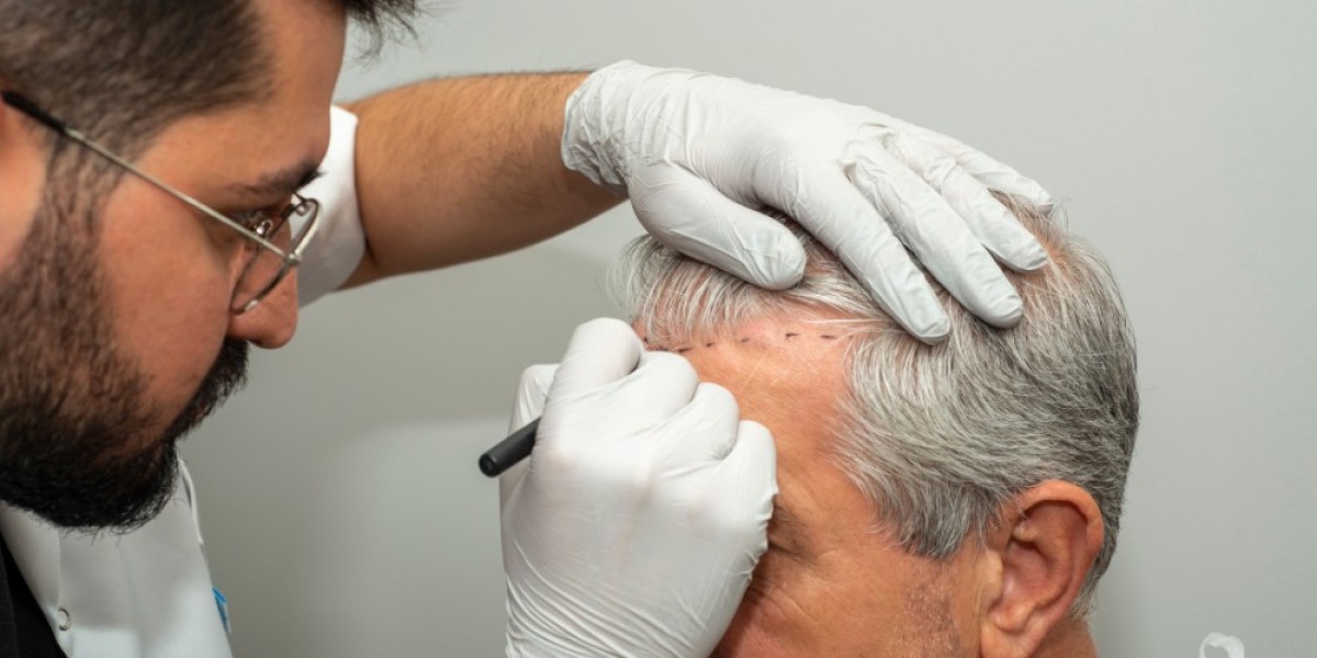 How a Hair Specialist Can Help Achieve Fuller, Thicker Hair