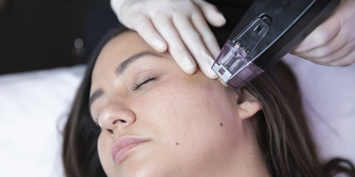 No Cuts, Just Snatch — Morpheus8 Treatment