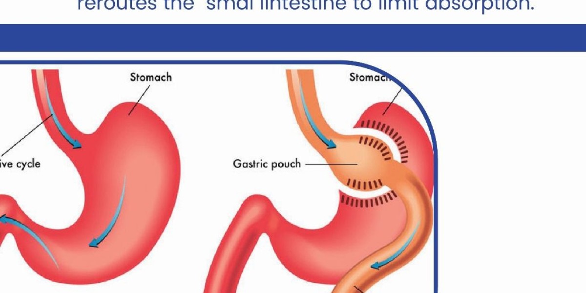 Advanced Laparoscopic & Metabolic Surgery in Abu Dhabi – Transforming Lives