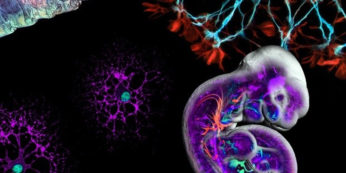 GE Healthcare Invests in Next-Gen MRI and CT Technologies