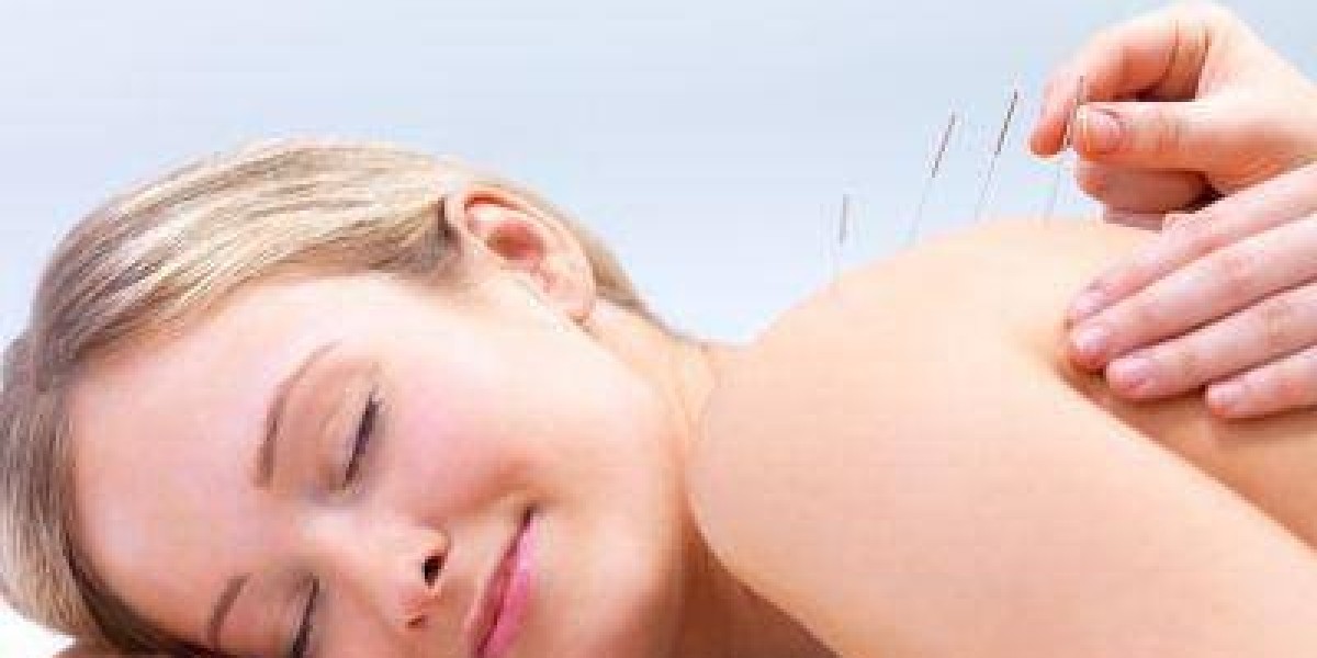 Natural Relief Through Acupuncture For Pain In Morristown – CM Harmony