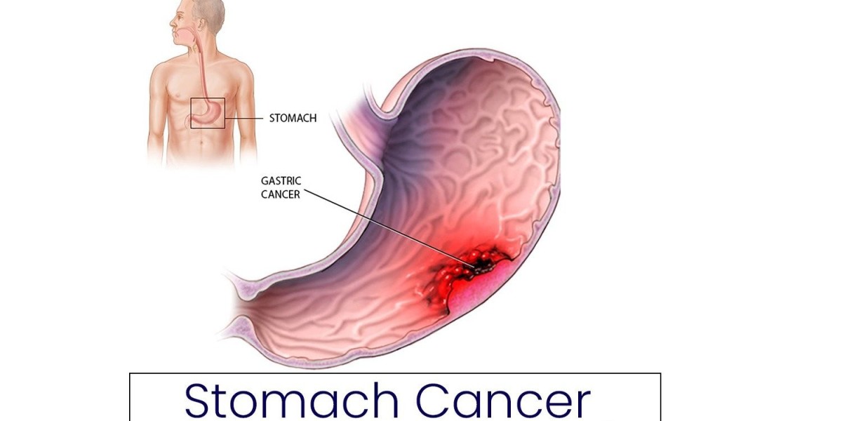 Best GI Cancer Surgeon in Bangalore – Dr. Bhushan Chittawadagi