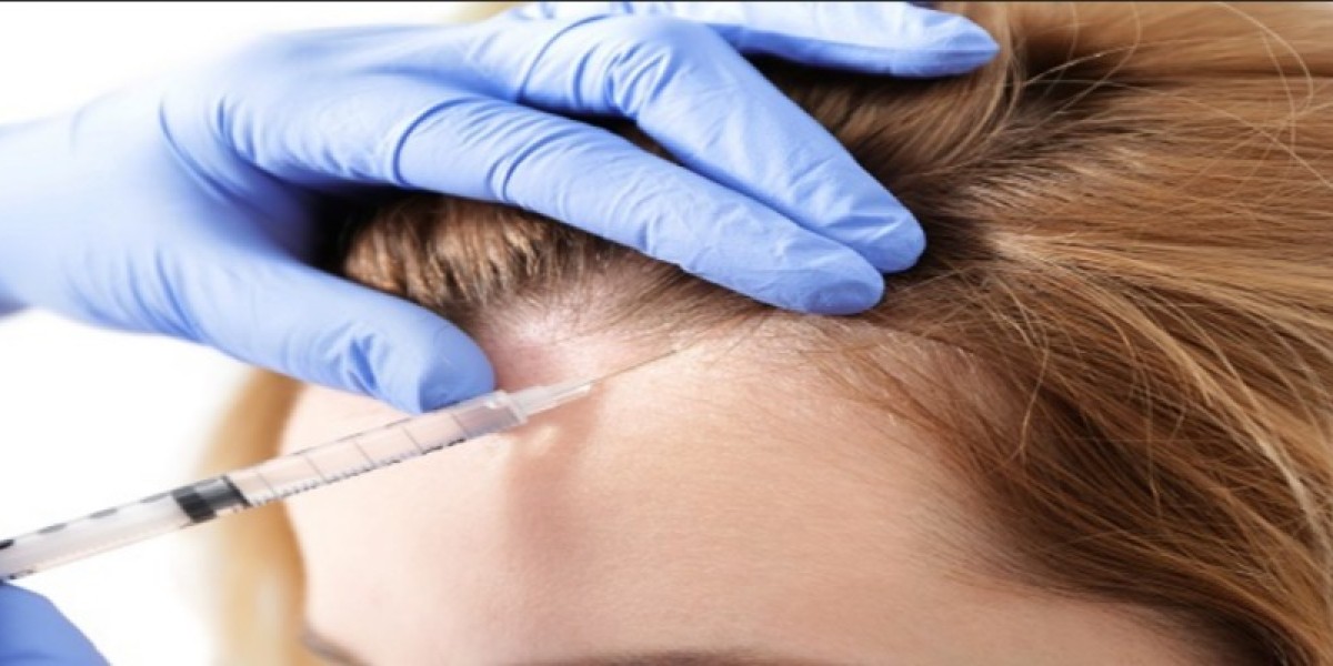 Why PRP Hair Treatment Boosts Hair Growth