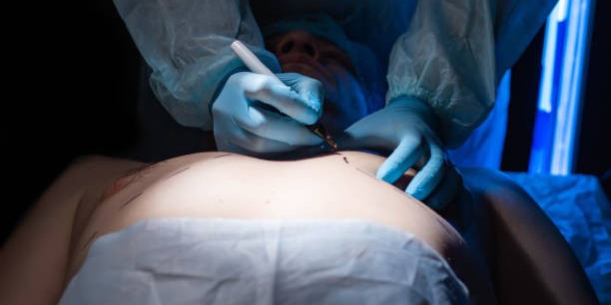 Top Clinics for Gynecomastia Surgery in Riyadh