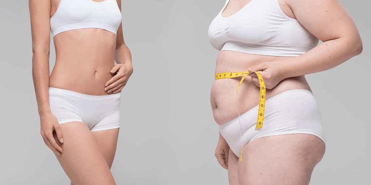 Can Wegovy Be Used For Belly Fat Loss?